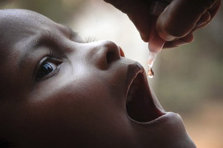 از بیماری فلج اطفال چه می‌دانیم؟