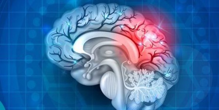 شناخت مکانیزم‌های آسیب مغزی با ارائه مدلی جدید توسط محققان دانشگاه صنعتی امیرکبیر