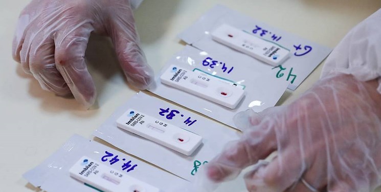 متخصص روسی: برای محافظت در برابر کرونا به سطوح مختلف آنتی‌بادی نیاز است