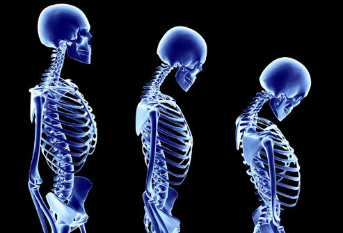 مراقب این علائم در سنین جوانی باشید مراقب این علائم در سنین جوانی باشید