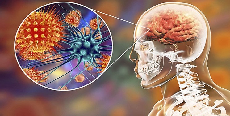 نشانه ابتلا به «مننژیت» نشانه ابتلا به «مننژیت»