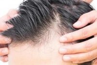 تقویت کننده های طبیعی موی سر را بشناسید! تقویت کننده های طبیعی موی سر را بشناسید!