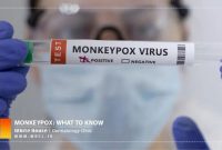 مسئولان بهداشتی انگلیس: ابتلا به ویروس آبله میمون همچنان رو به افزایش است