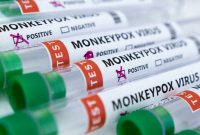تعداد مبتلایان به ویروس آبله میمون در سنگاپور به ۱۶ نفر رسید