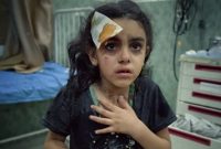 فریاد کودک زخمی فلسطینی: اسرائیل دولت نیست؛ قاتل کودکان است