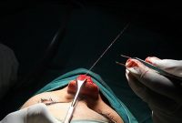 تشدید مجازات تخلفات جراحیهای زیبایی/ انجام جراحی زیبایی در آرایشگاه تخلف است تشدید مجازات تخلفات جراحیهای زیبایی/ انجام جراحی زیبایی در آرایشگاه تخلف است