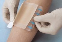 زخم پوش نوین آنتی باکتریال با گیاه آویشن ساخته شد