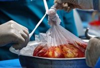 حمایت خانواده کارکنان شهرداری تهران از اهدای عضو حمایت خانواده کارکنان شهرداری تهران از اهدای عضو