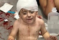 شهادت 500 فلسطینی در حمله صهیونیستها به بیمارستان غزه شهادت 500 فلسطینی در حمله صهیونیستها به بیمارستان غزه